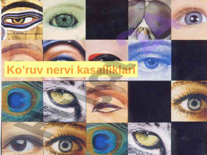 Ko'ruv nervi kasalliklari tahlil va tasniflari