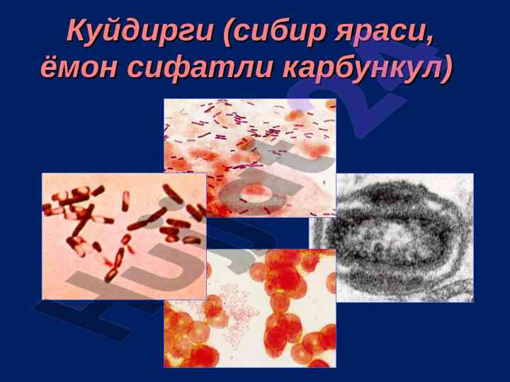 Сибирская язва: этиология и профилактика