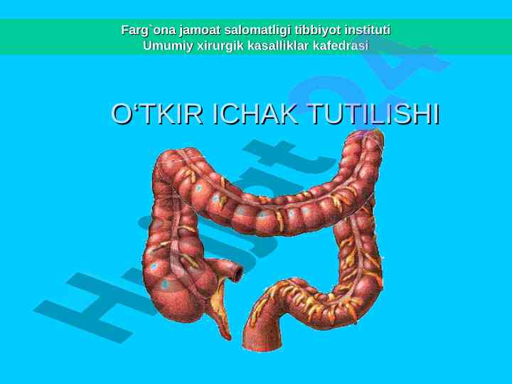 O‘tkir ichak tutilishi va uning muammolari