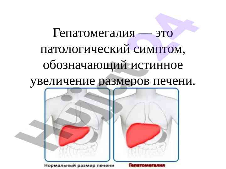 Gepatomagliya patologik simptomi va diagnostika