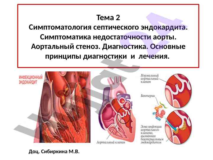 Симптоматология септического эндокардита и диагностика