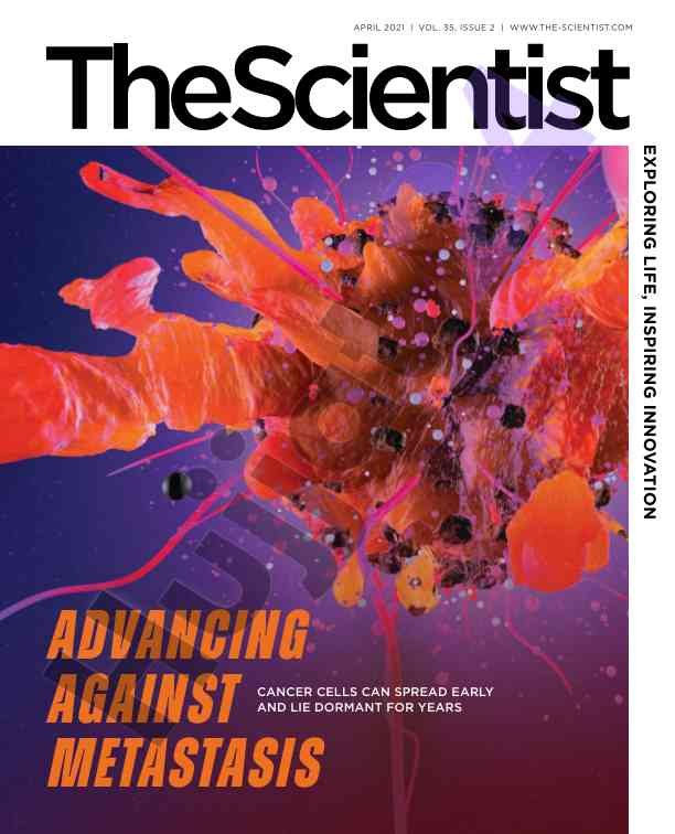 Cancer cells spread early and dormant metastasis insights