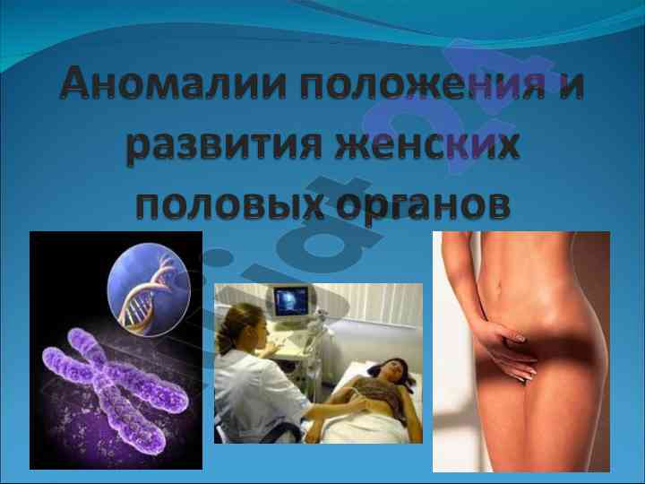 Правильное положение половых органов у женщин