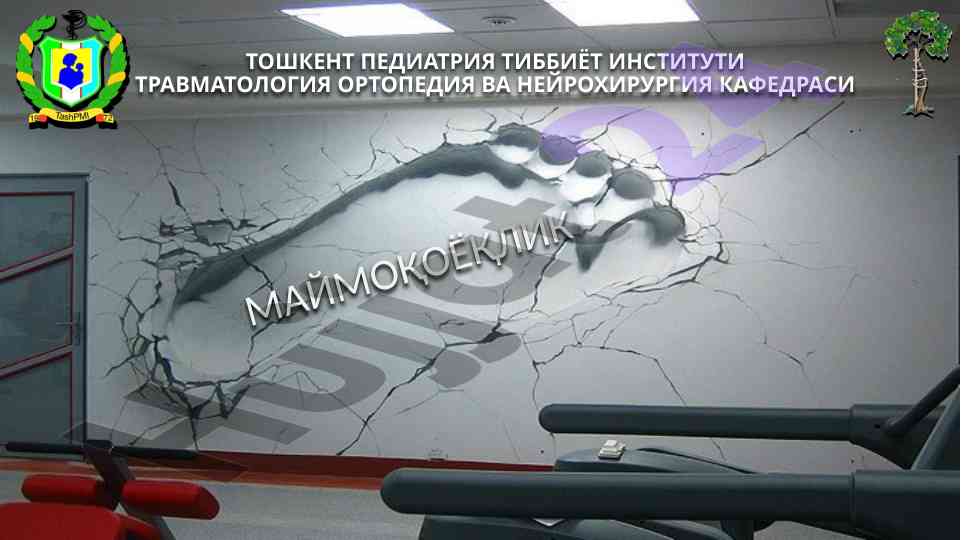 Травматология ортапедия вa нейрохирургия мавзулари
