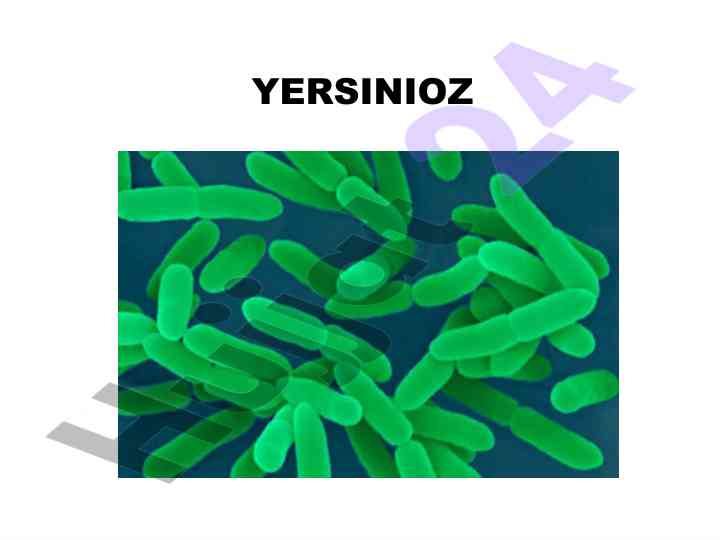 Yersinioz va uning e'tiologik asoslari