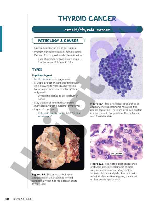 Thyroid cancer types overview and pathology insights