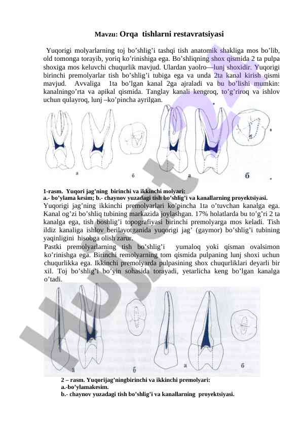 Yuqori tishlar restavratsiyasi tahlili