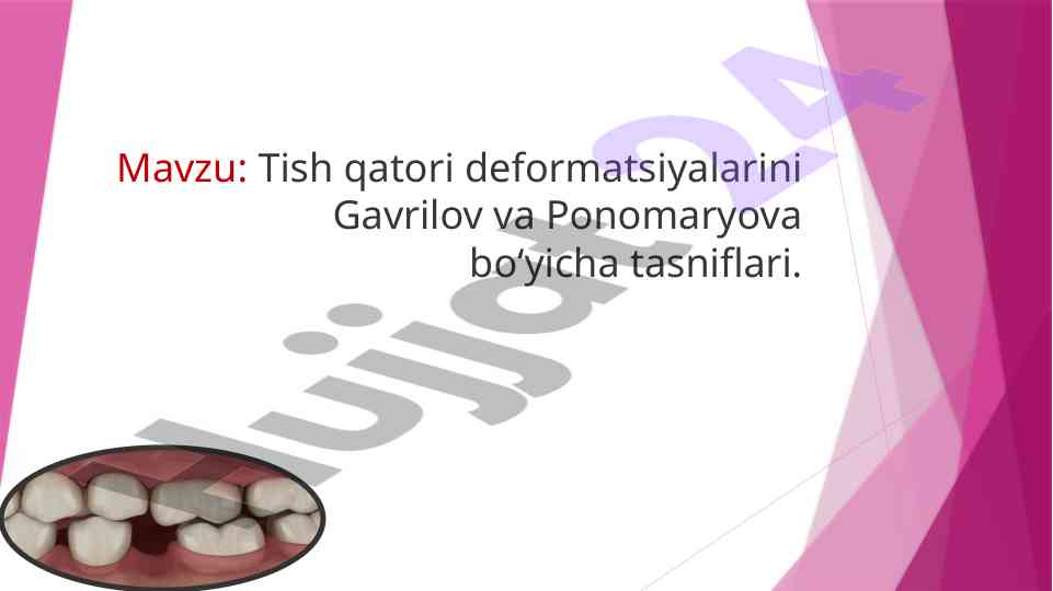 Tish qatori deformatsiyalarini tasnifi va ta'siri
