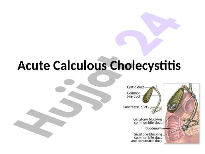 Acute calculous cholecystitis clinical problem overview