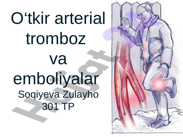 O‘tkir arterial tromboz va emboliya tushunchalari