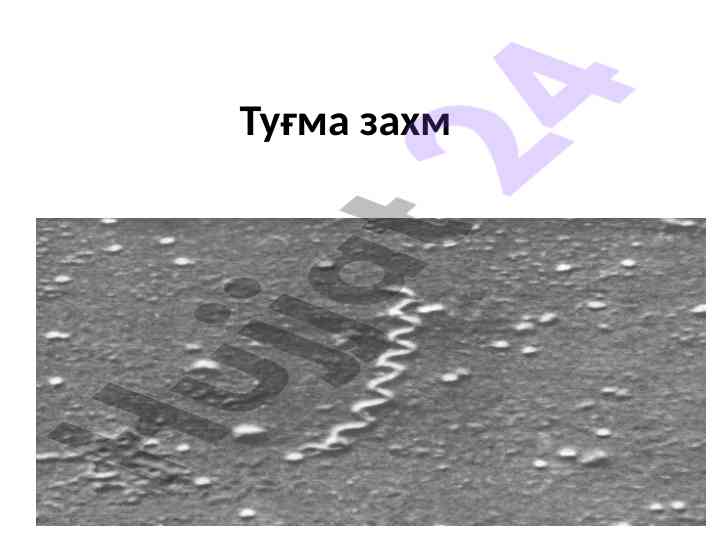 Туғма захмнинг классификацияси ва ўтказилиши