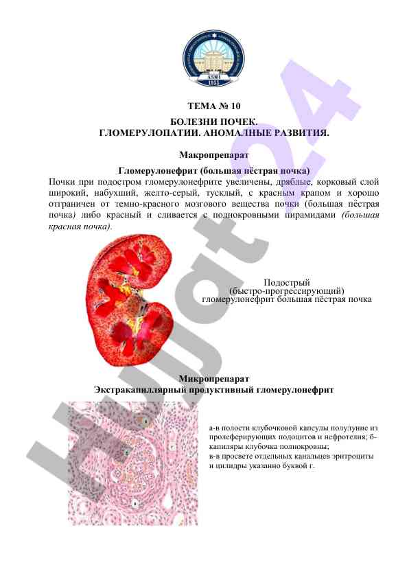 Bolezni pochek glomerulopatii anomalnye razvitiya