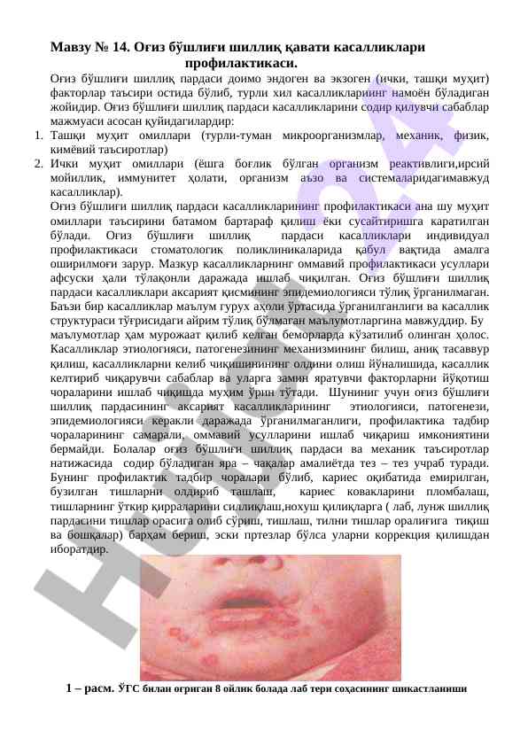 Оғиз бўшлиғи шиллиқ қавати касалликлари профилактикаси