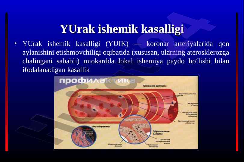 Yurak ishemik kasalligi: davolash takliflari va strategiyalari
