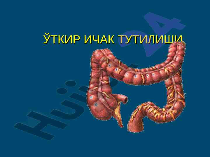 Ўткир ичак тутирилиши муаммоси тўғрисида илмий ҳаётий