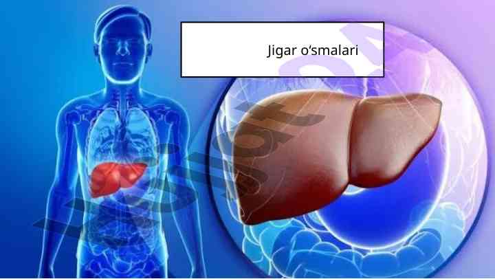 Jigar o'smalari diagnostikasi va davolash yondashuvlari