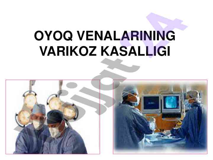 Oyoq venalarining varikoz kasalligi haqida ma'lumotlar