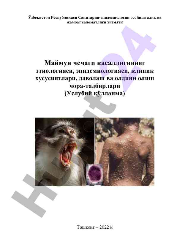 Маймун чечаги касаллигининг этиологияси ва клиник хусусиятлари