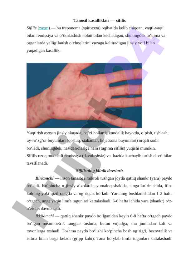 Sifilis: tanosil kasalliklari va davolash usullari