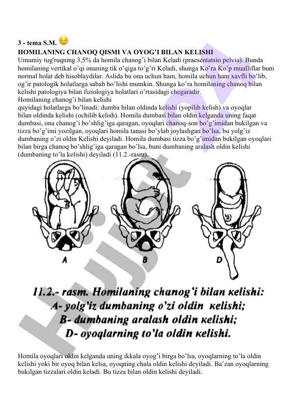 Homilaning chanoq qismi va oyog’i bilan kelishi