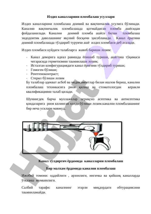 Илдиз каналларини пломбалаш усуллари тўғрисида