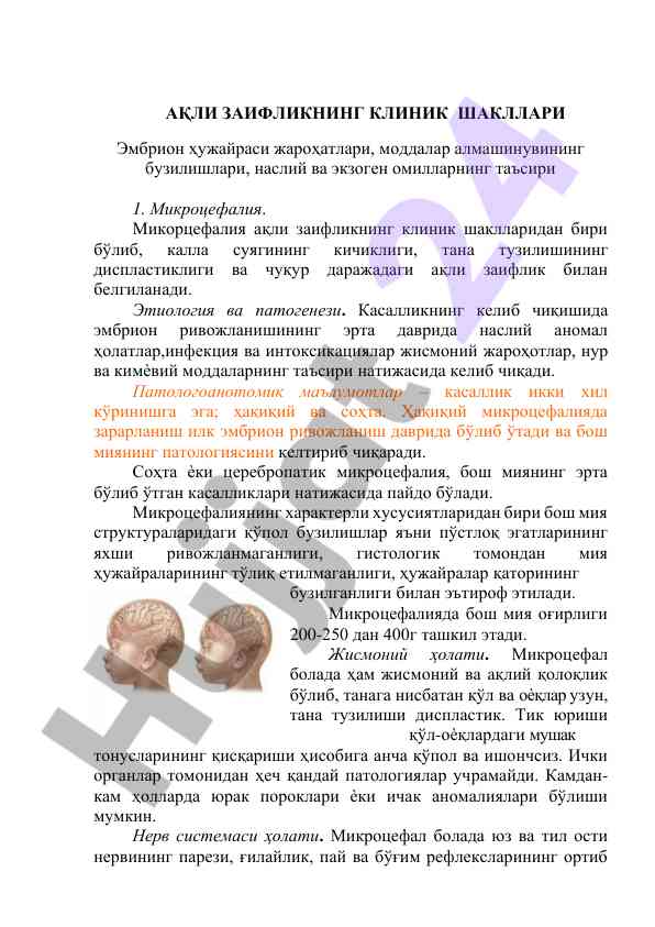 Микроцефалия ва ақли заифликнинг клиник шакллари