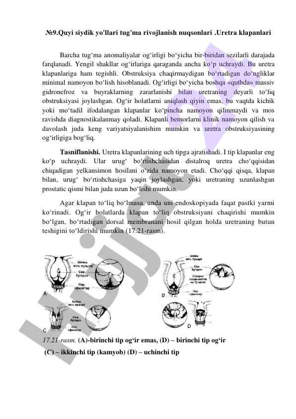 Tug'ma rivojlanish nuqsonlari va uretra klapanlari