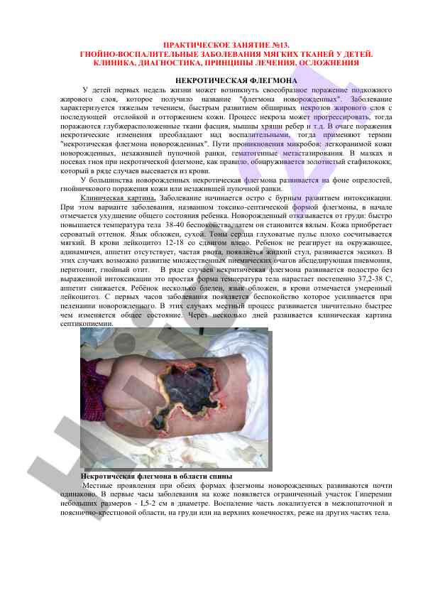 Гнойно-воспалительные заболевания мягких тканей