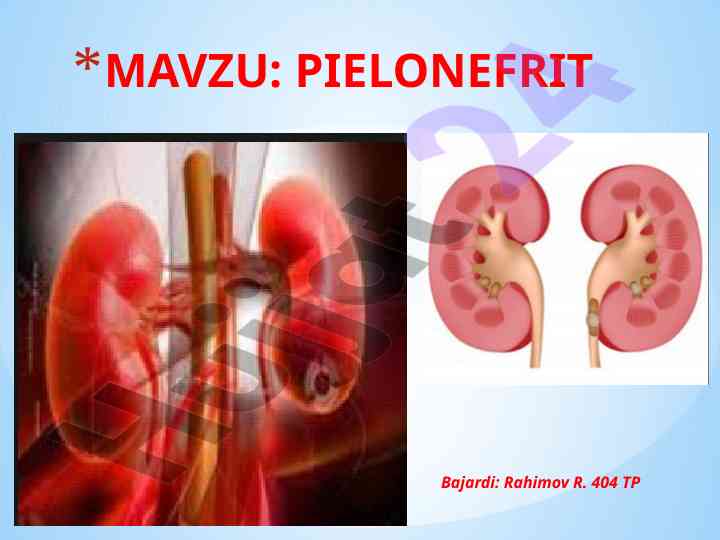 Pielonefrit kasalligi haqida ma'lumotlar