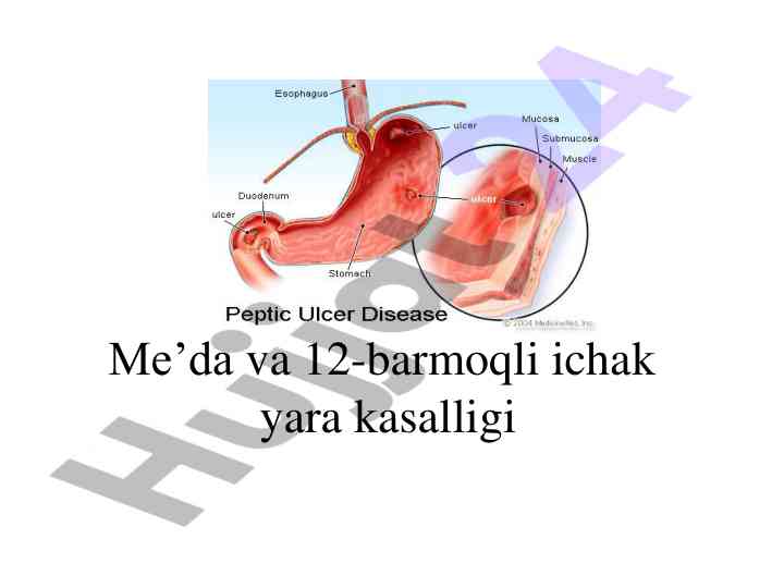Me’da va 12-barmoqli ichak yarasi tarixiy asoslari