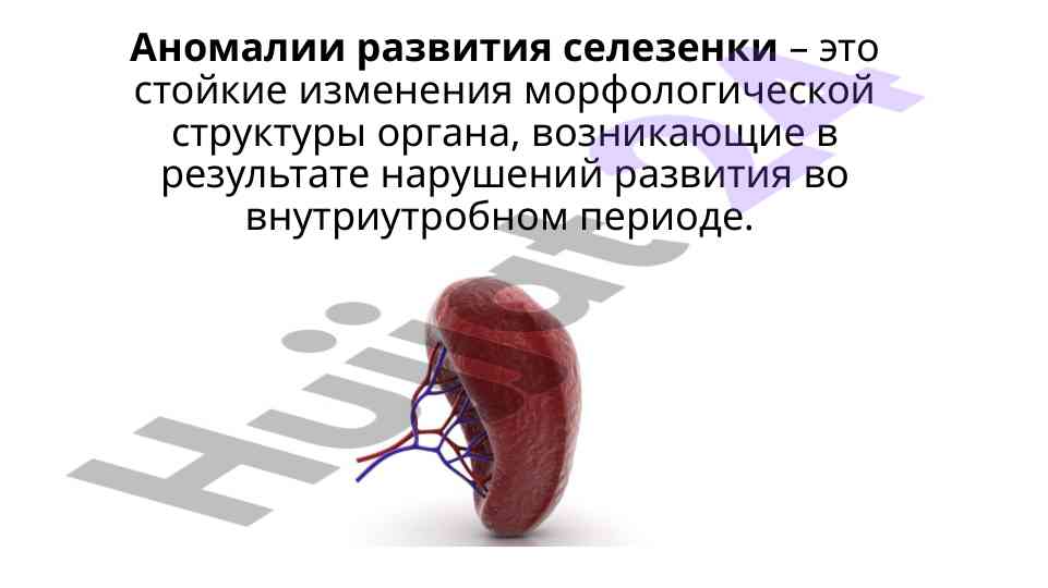 Аномалии развития селезенки и их причины