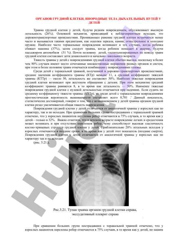 Травма грудной клетки у детей и их исходы