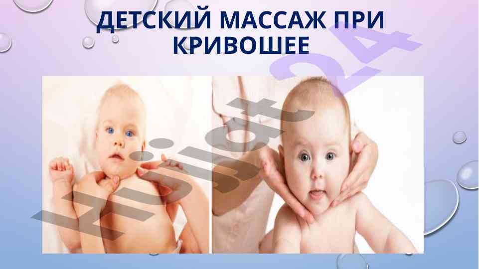 Детский массаж при кривошее и его эффективность