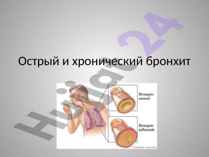 Острый и хронический бронхит: этиология и классификация