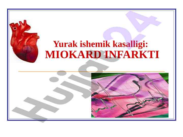 Yurak ishemik kasalligi: miokard infarkti haqida