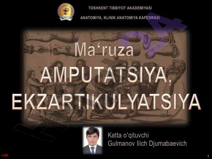 Amputatsiya va ekzartikulyatsiya turlari