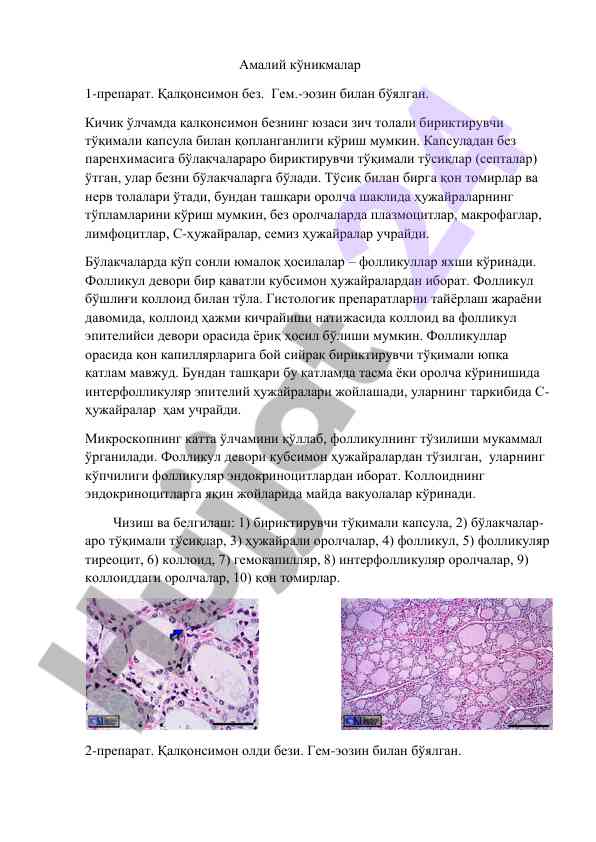 Гистологик препаратларда қалқонсимон без тадқиқоти