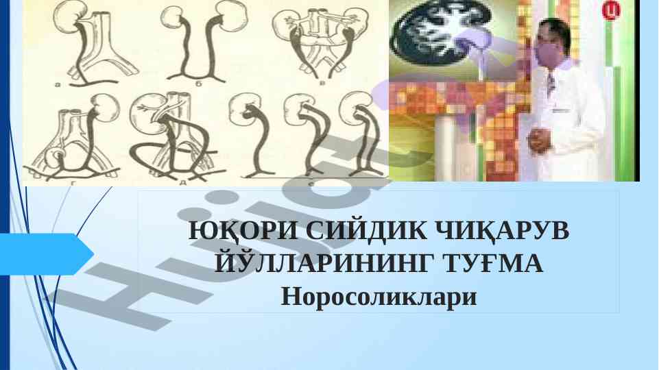 Туғма норасоликлар ва сийдик чиқариш йўллари