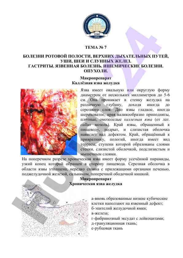 Болезни ротовой полости и язва желудка
