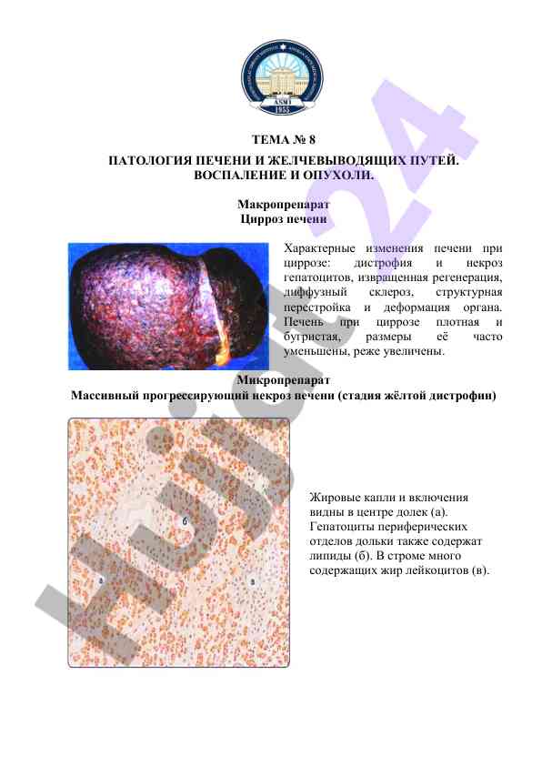 Patologiya pecheni va zhelchevodyashchikh putei