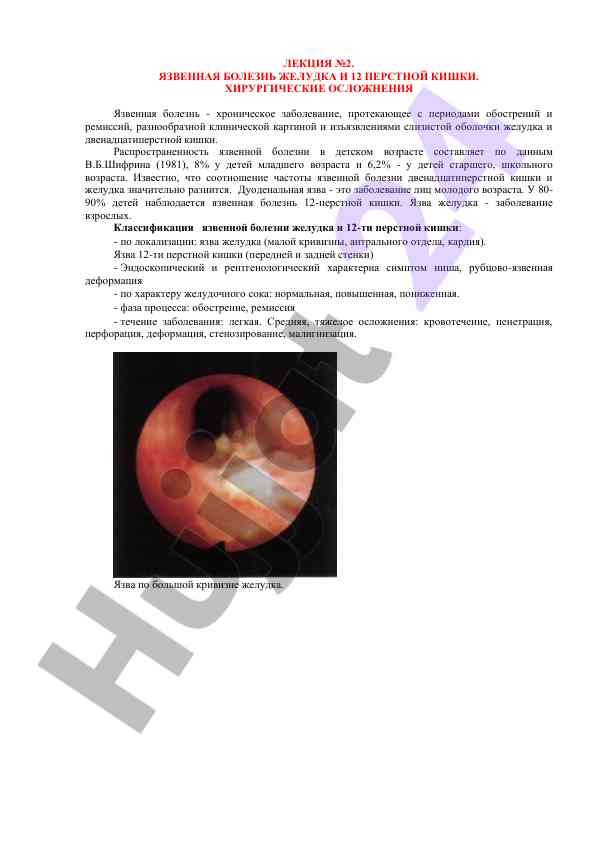 Лекция №2 язвенная болезнь желудка и 12 перстной кишки