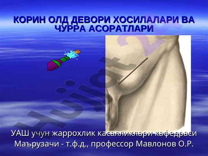 Корон олд девори хосилалари ва чурра асоратлари