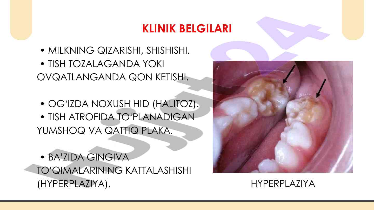 Tasodifiy etekning YouTube videosi