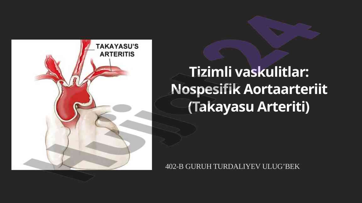 Tizimli vaskulitlar: nospesifik aortaarteriit tahlili