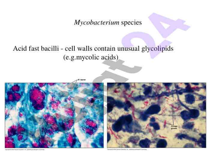 Mycobacterium species and associated diseases overview