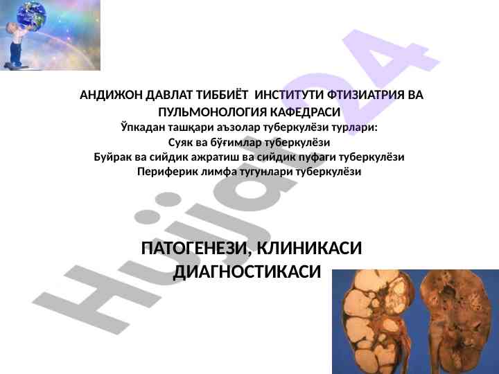 Ўпкадан ташқари туберкулёз турлари бўйича маъруза