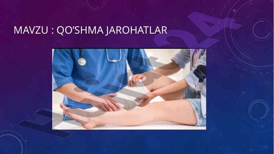 Qo’shma jarohatlar politravma tahlil