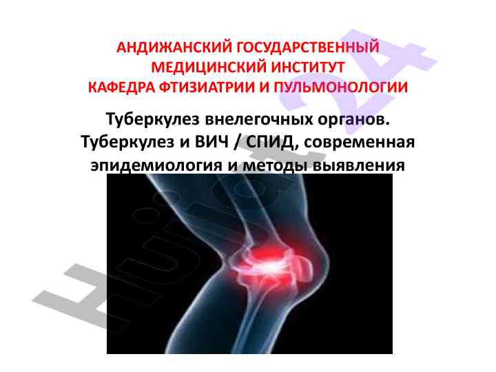 Туберкулез внелегочных органов и его эпидемиология