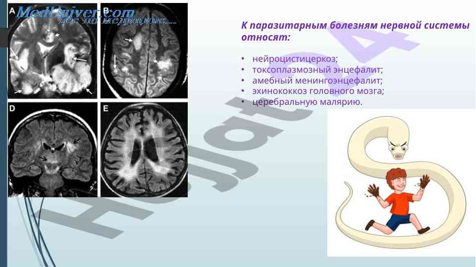 Паразитарные болезни нервной системы
