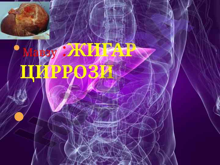 Жигар циррози бўйича эпидемиология ва этиология